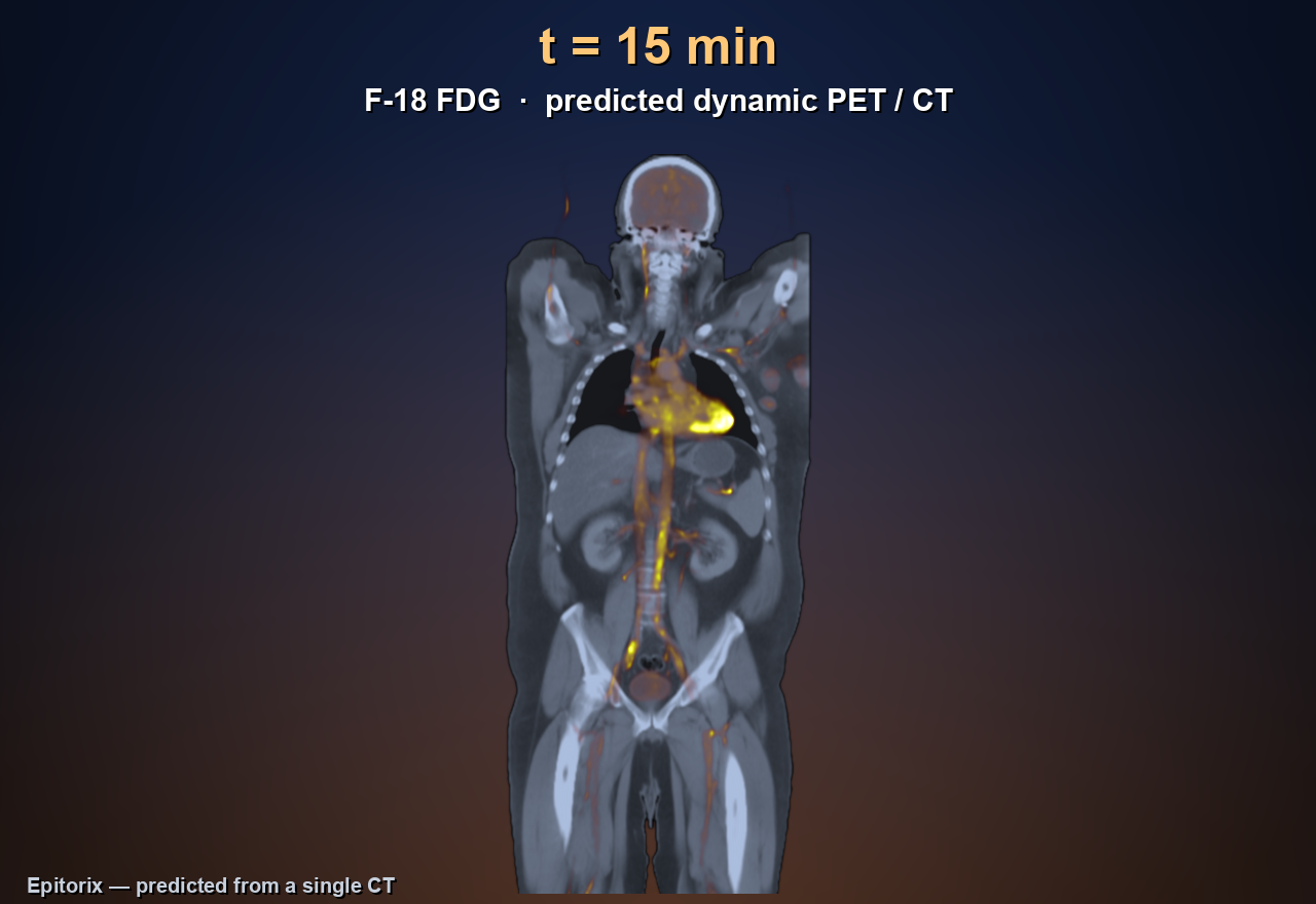 AI-predicted dynamic FDG-PET/CT from a single CT, 1 to 60 minutes post-injection